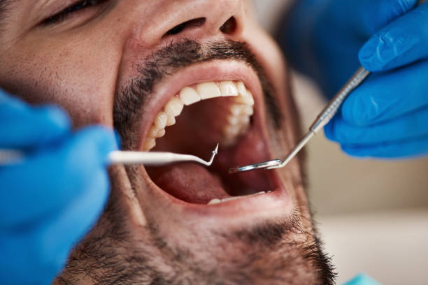 Best Same-Day Emergency Dental Services in Morton, WA